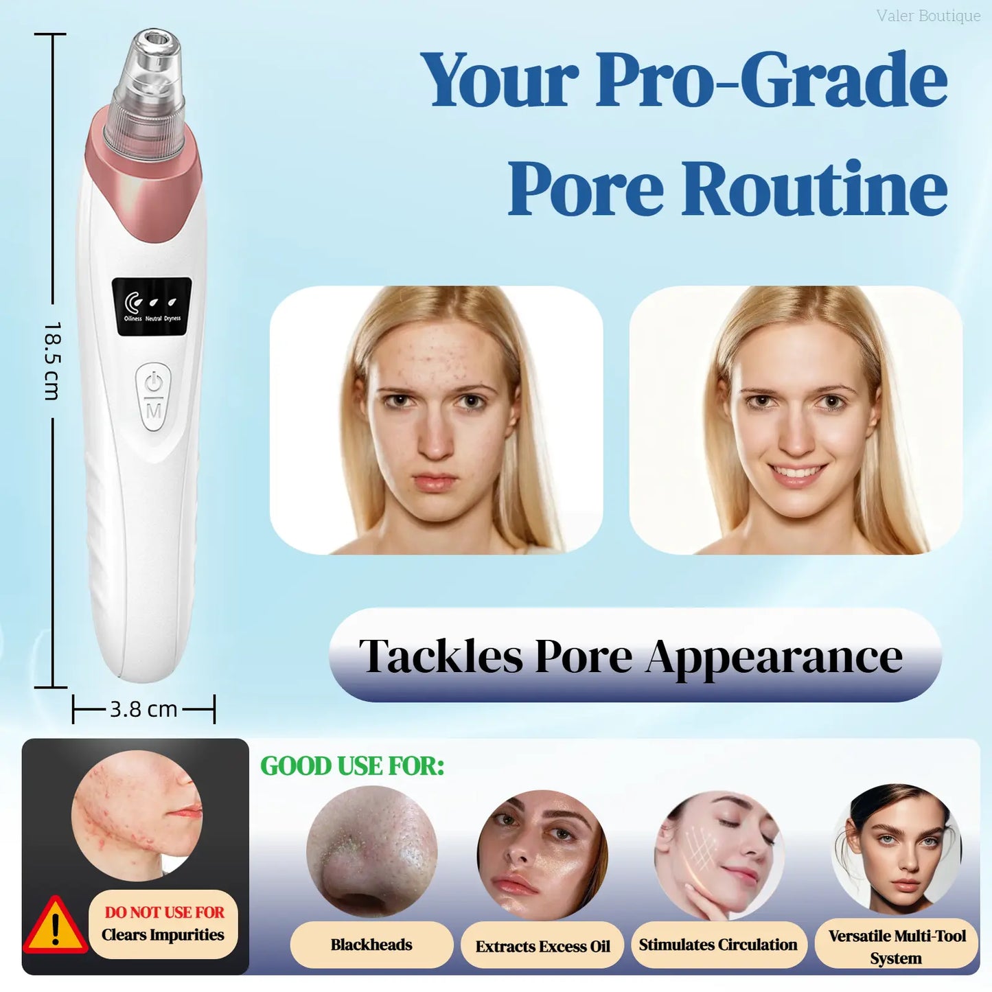 Electric Blackhead Remover – USB Pore Vacuum Facial Cleaner